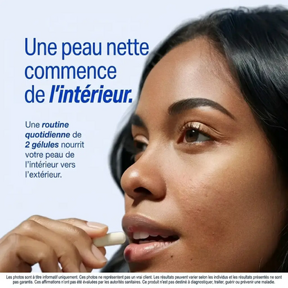 MYVA™ Anti-Acné Hormonale