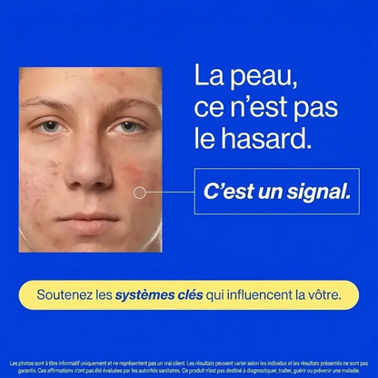 MYVA™ Anti-Acné Hormonale